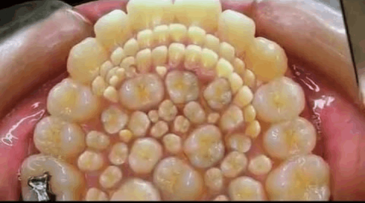 dientesversionfinal